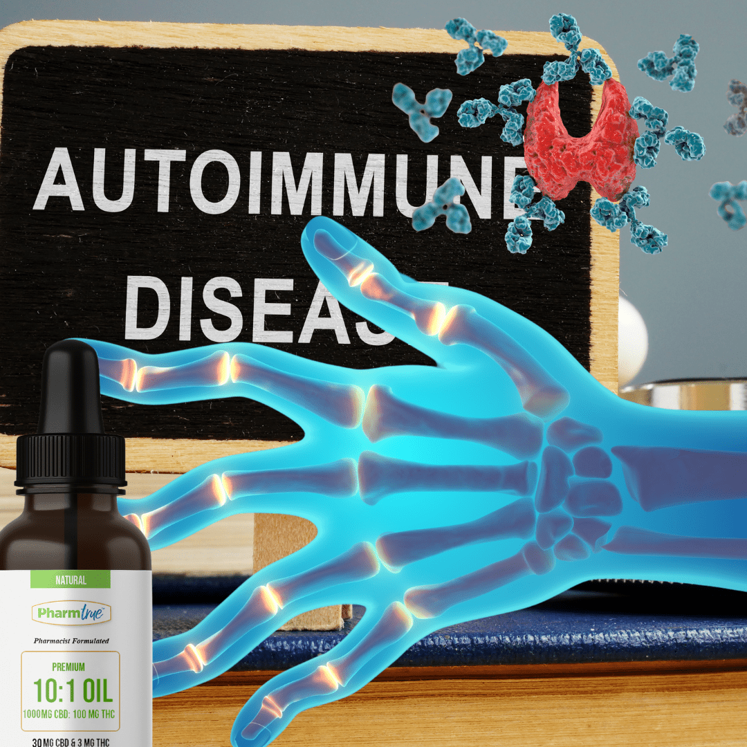 Cannabis and Autoimmune Conditions: A Real Solution for Psoriatic Arthritis